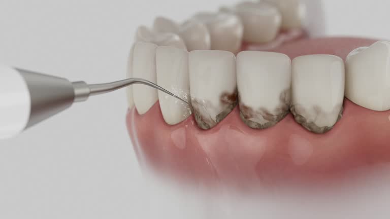 Trusted Wisdom Tooth Removal service in Sharpsburg, NC - Dentist Open Now